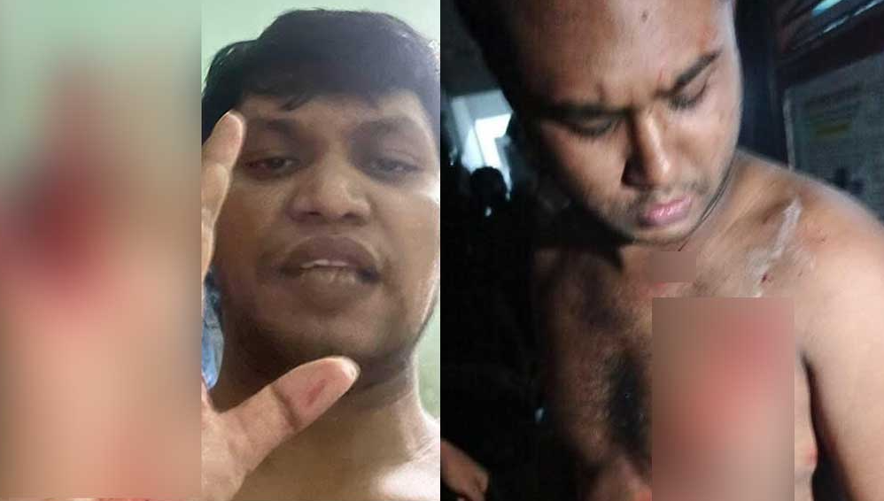 ঢাবি শিক্ষার্থীকে ছুড়িকাঘাত করেছে ভিপি পদপ্রার্থী
