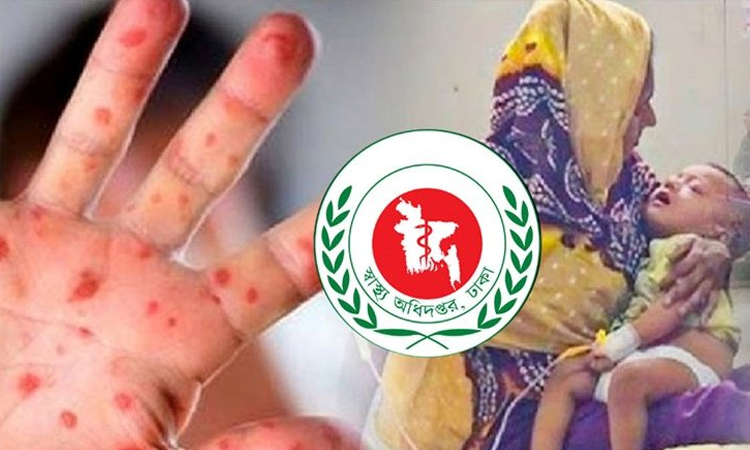 হাম ও উপসর্গে প্রাণ গেল আরও ৫ শিশুর