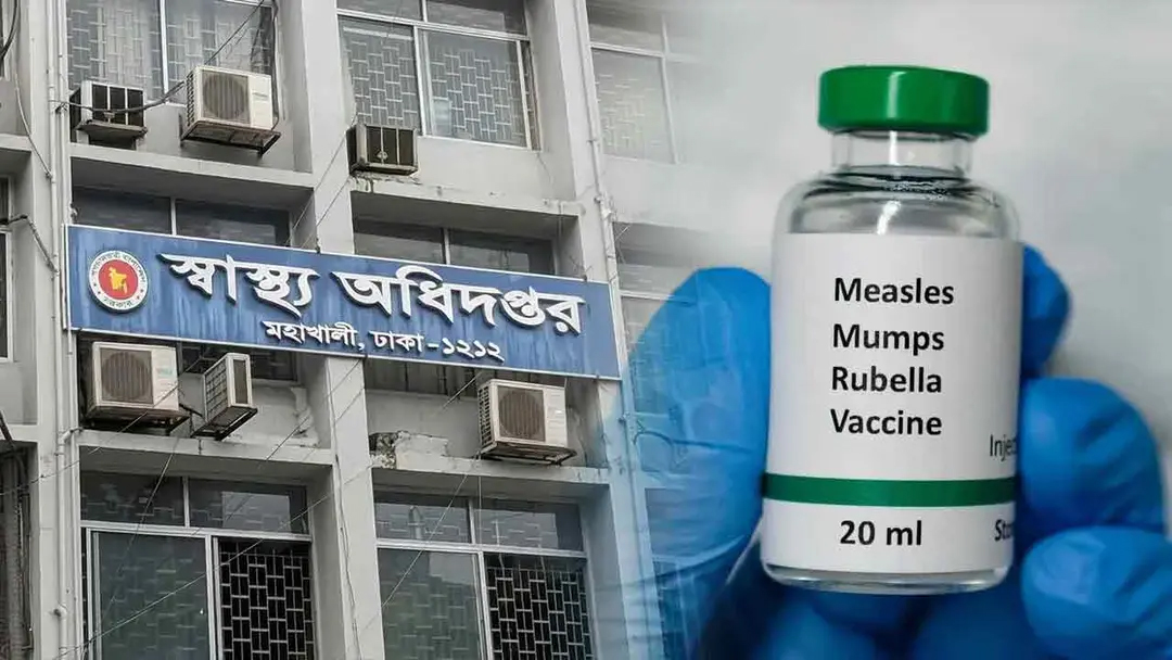 হাম পরিস্থিতির আরও অবনতি, ২৪ ঘণ্টায় ১১ শিশুর মৃত্যু