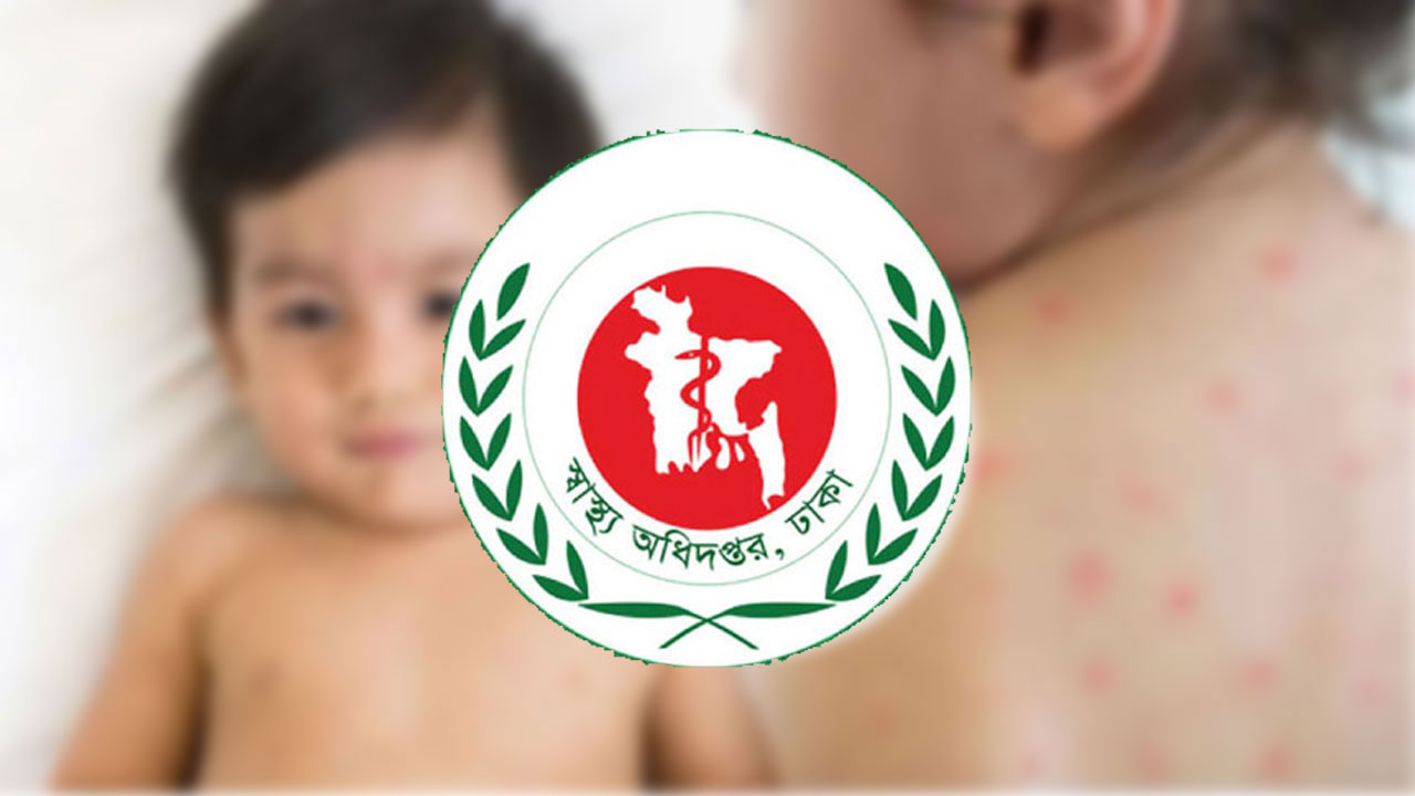 দেশে হাম ও উপসর্গে আরও ১২ শিশুর মৃত্যু